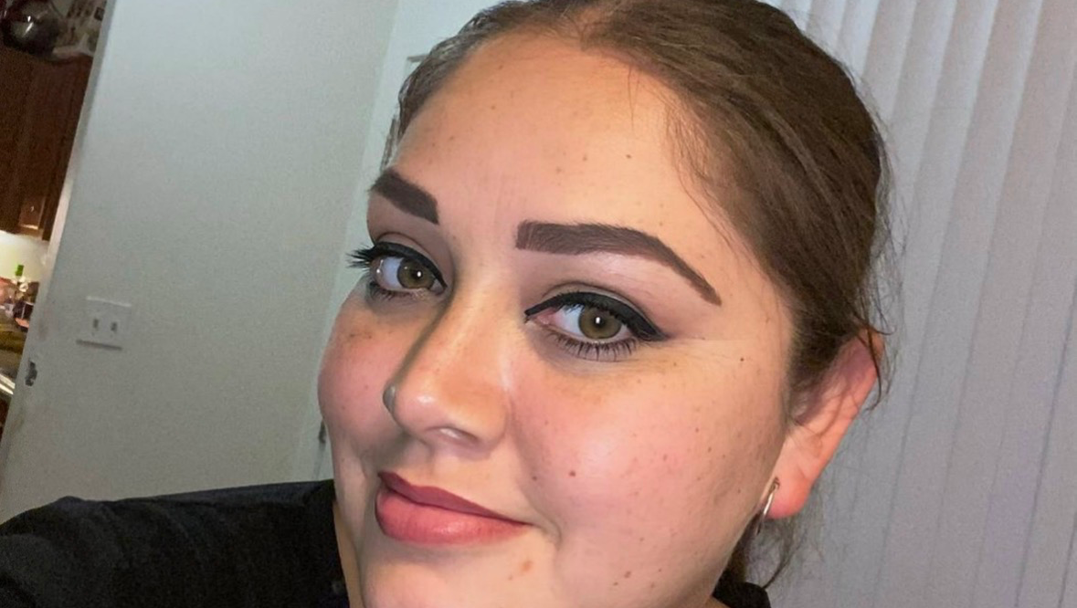 Help  Gloria Heal for Medical Expenses Recovery photo