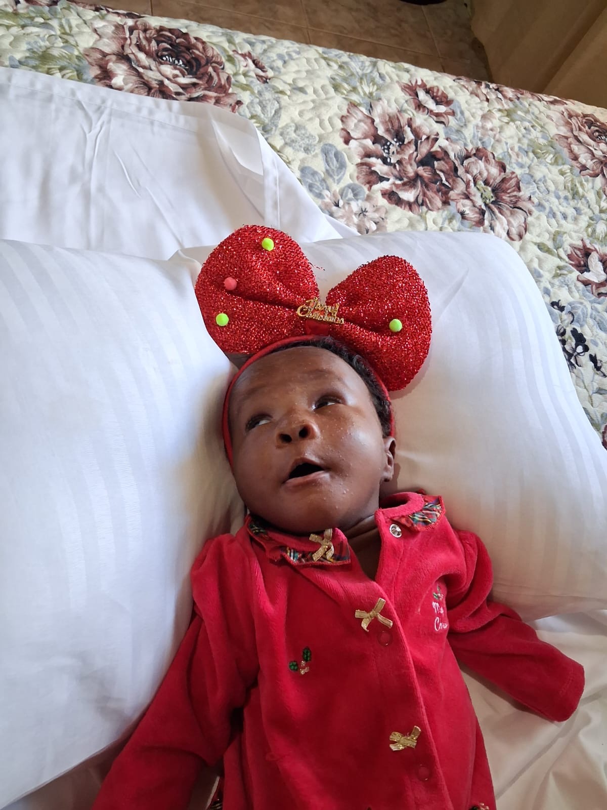 Help Anna-Olivia Thrive Despite Trisomy 13 campaign photo, 2 of 5