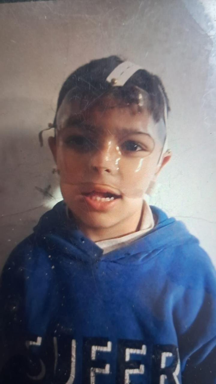 Medical care for Mustafa, child survivor of bombing campaign photo, 7 of 8