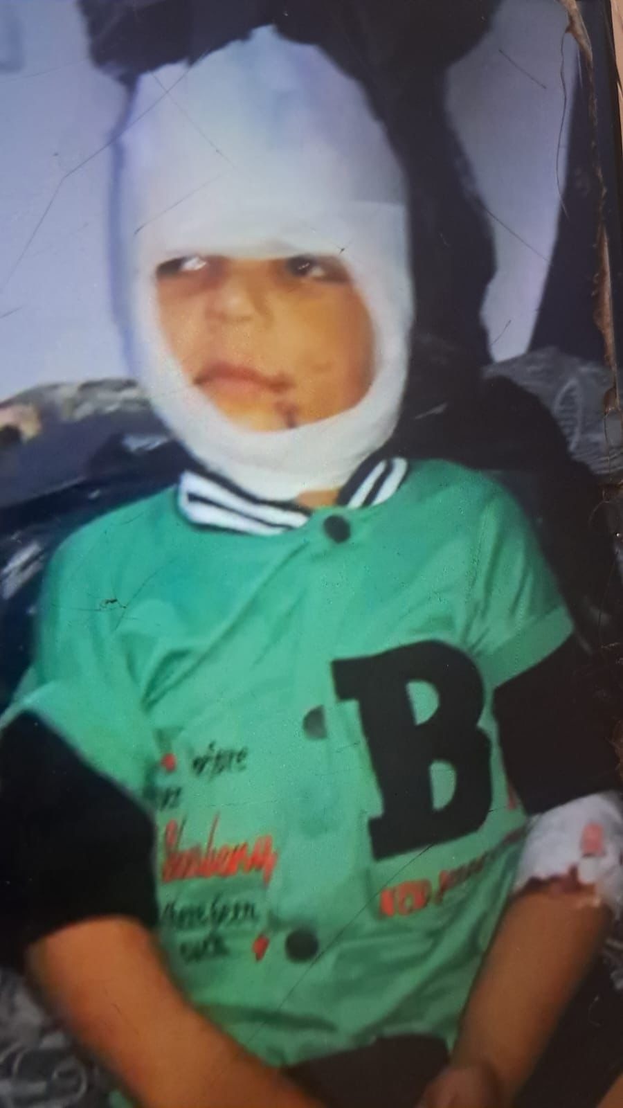 Medical care for Mustafa, child survivor of bombing campaign photo, 2 of 8