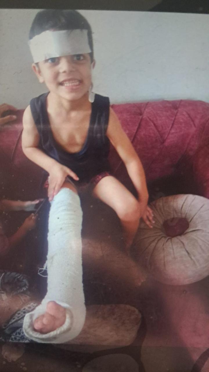 Medical care for Mustafa, child survivor of bombing campaign photo, 5 of 8