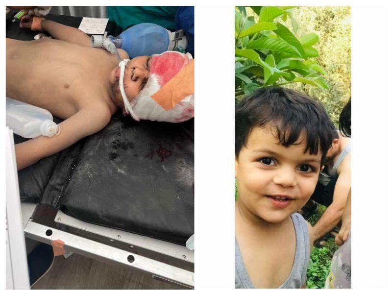 Medical care for Mustafa, child survivor of bombing campaign photo, 6 of 8