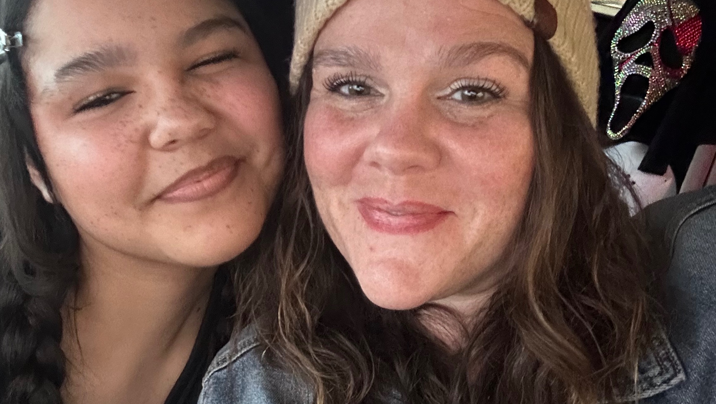 Help Save Sophia’s Smile photo