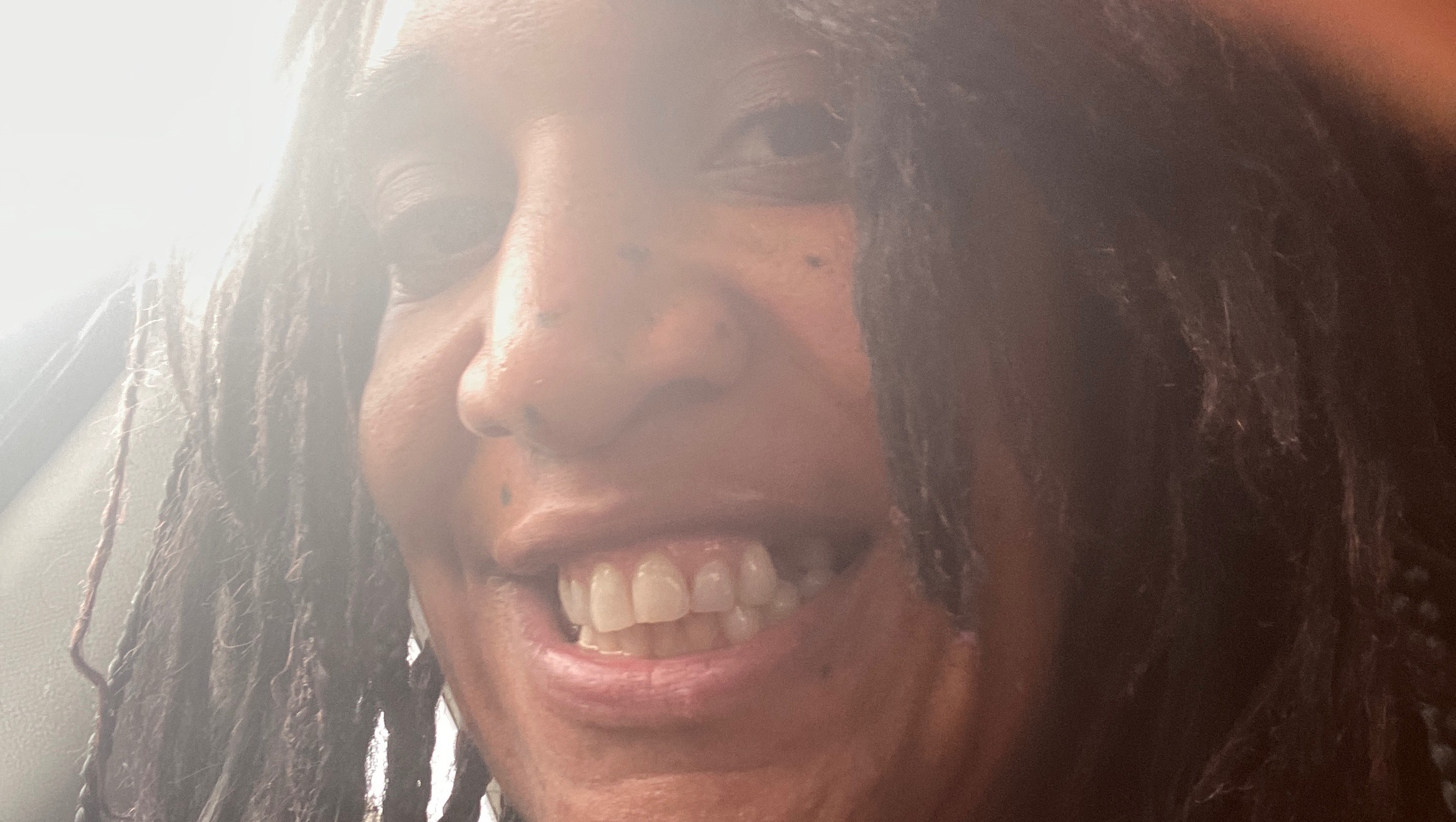 Help Fund Critical Dental Treatments photo