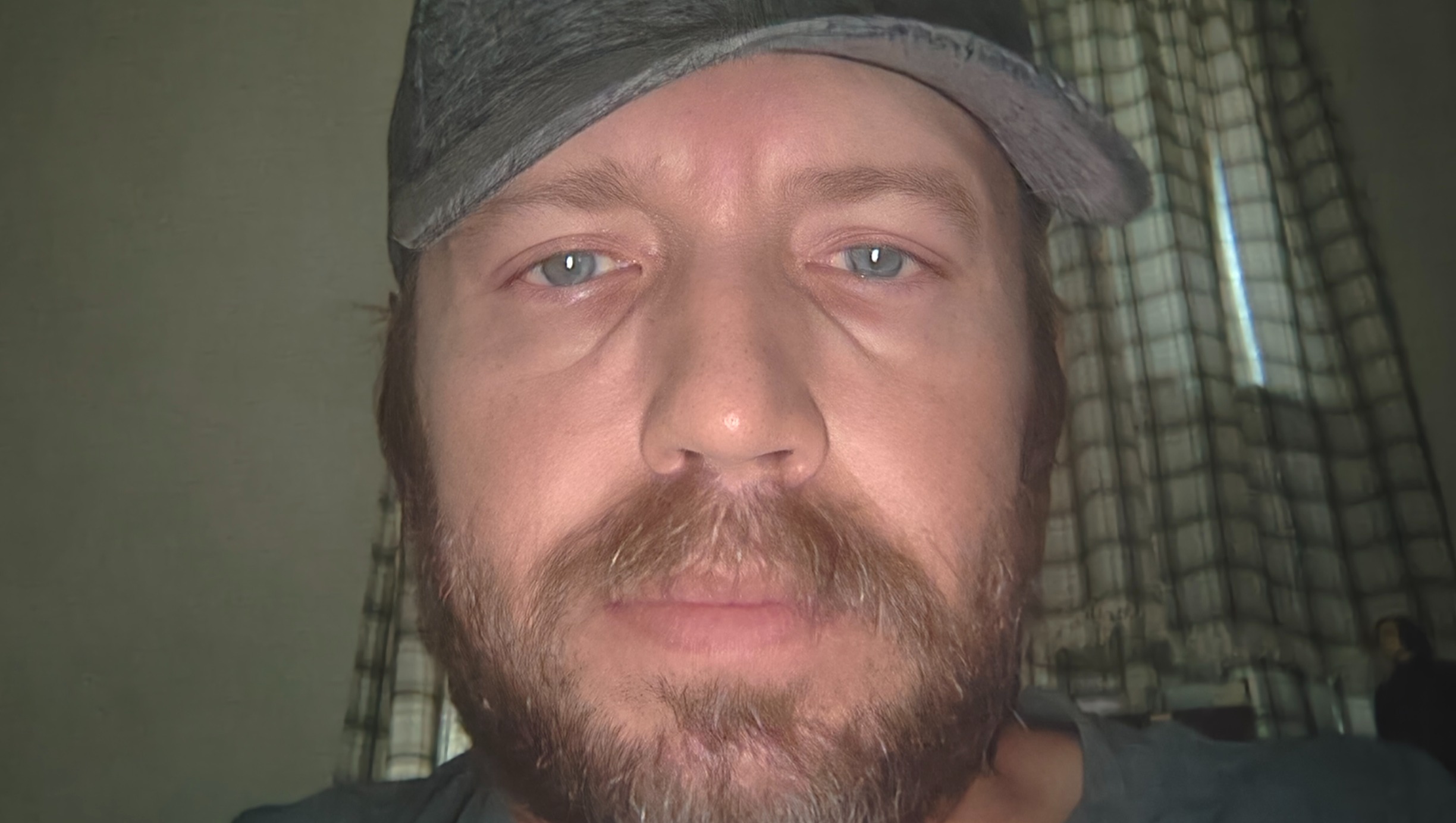 Support Bobby's Recovery After Kidney Transplant photo