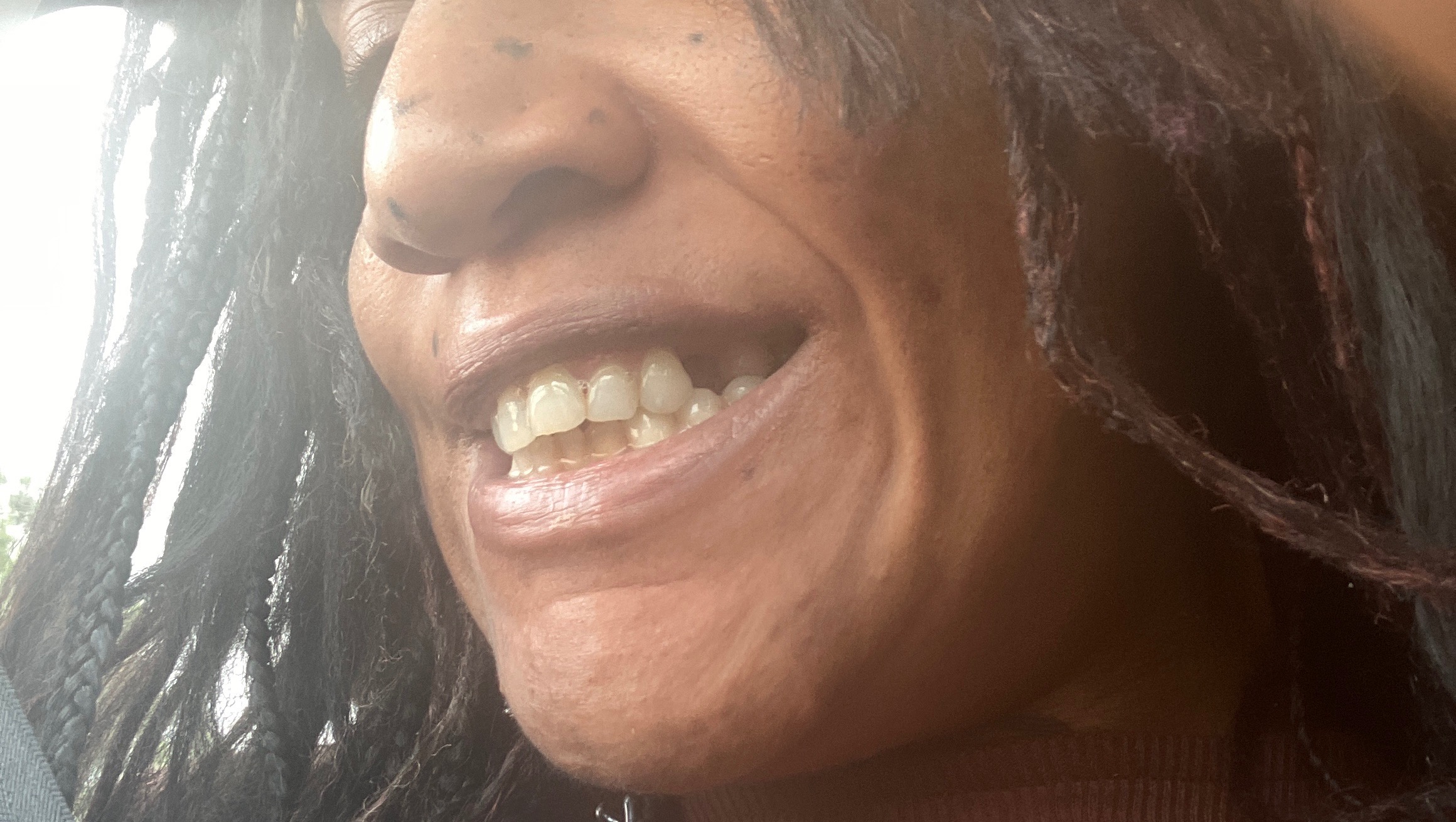 Help Viv Restore Dental Health & Confidence photo