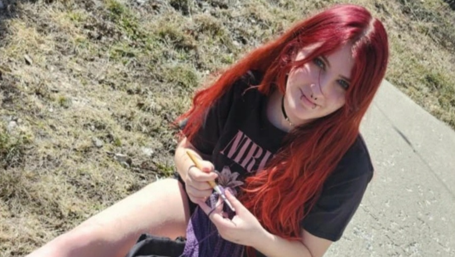 AB Artist (Kiara's) Surgery Fund (Jaw&Dental) photo