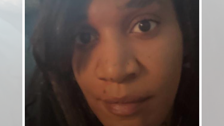 Help Viv Get Urgent Dental Care photo