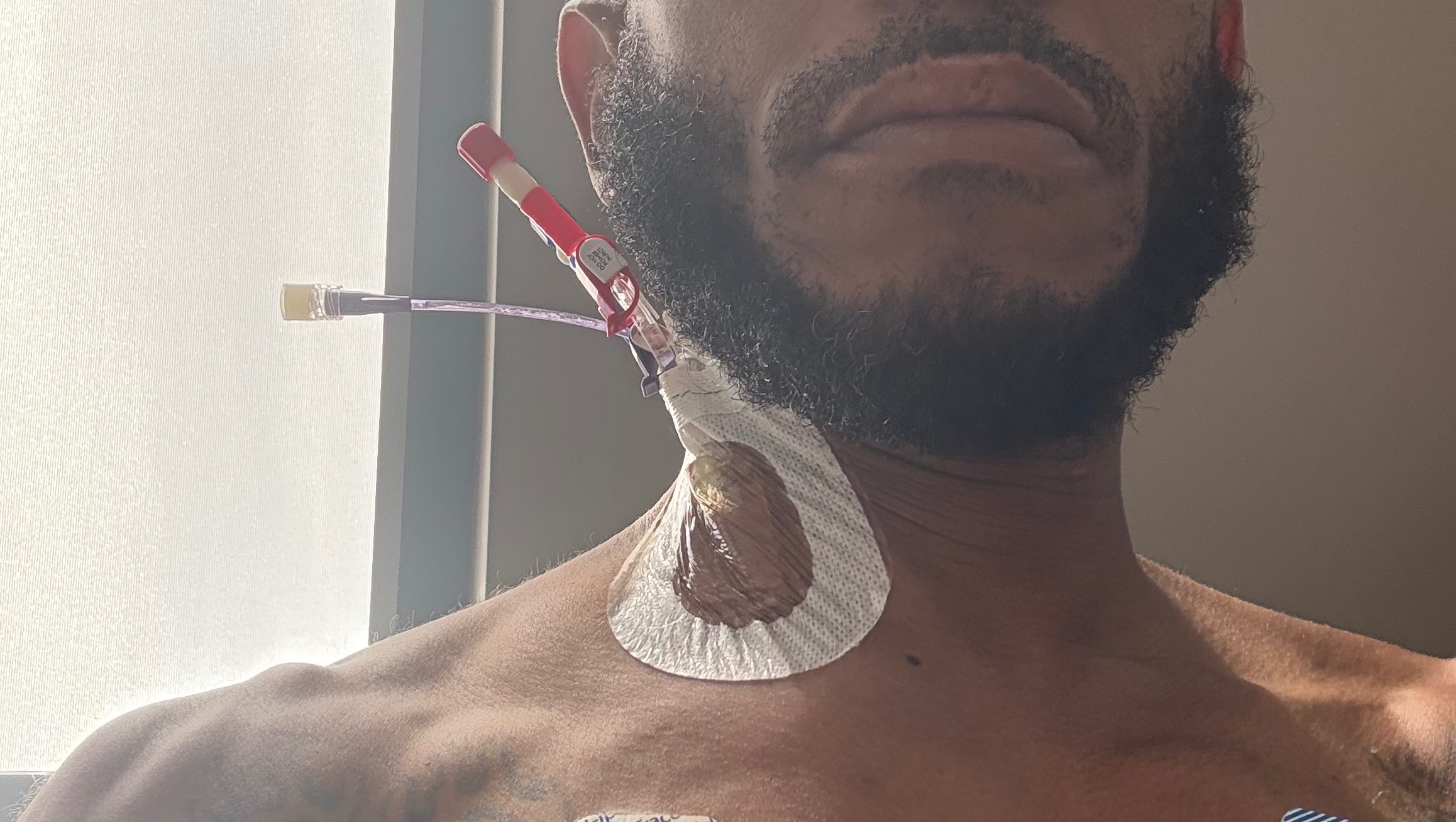 Help Me Fight Stage 4 Lymphoma photo