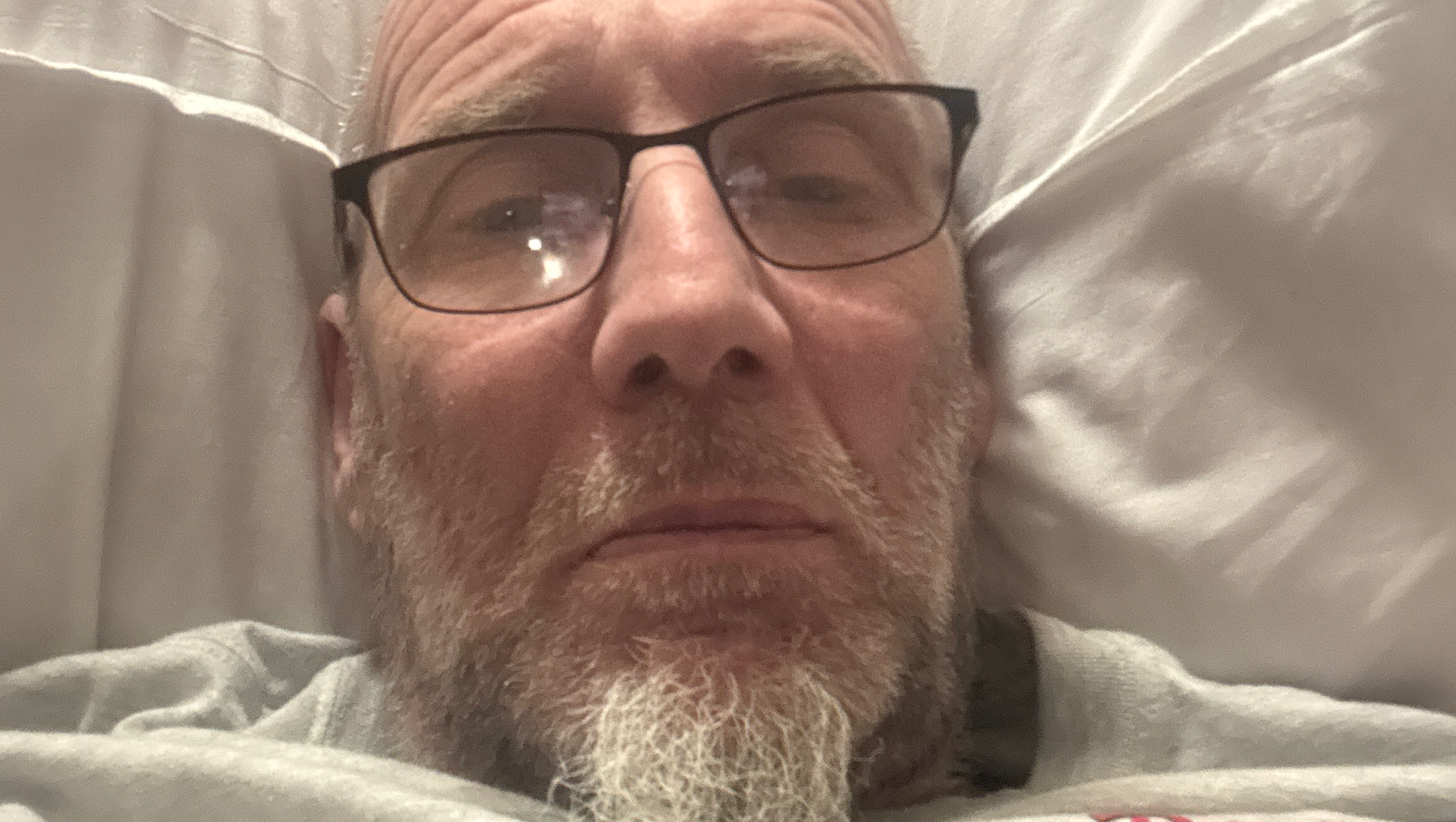 Homeless with Secondary progressive multiple sclerosis photo