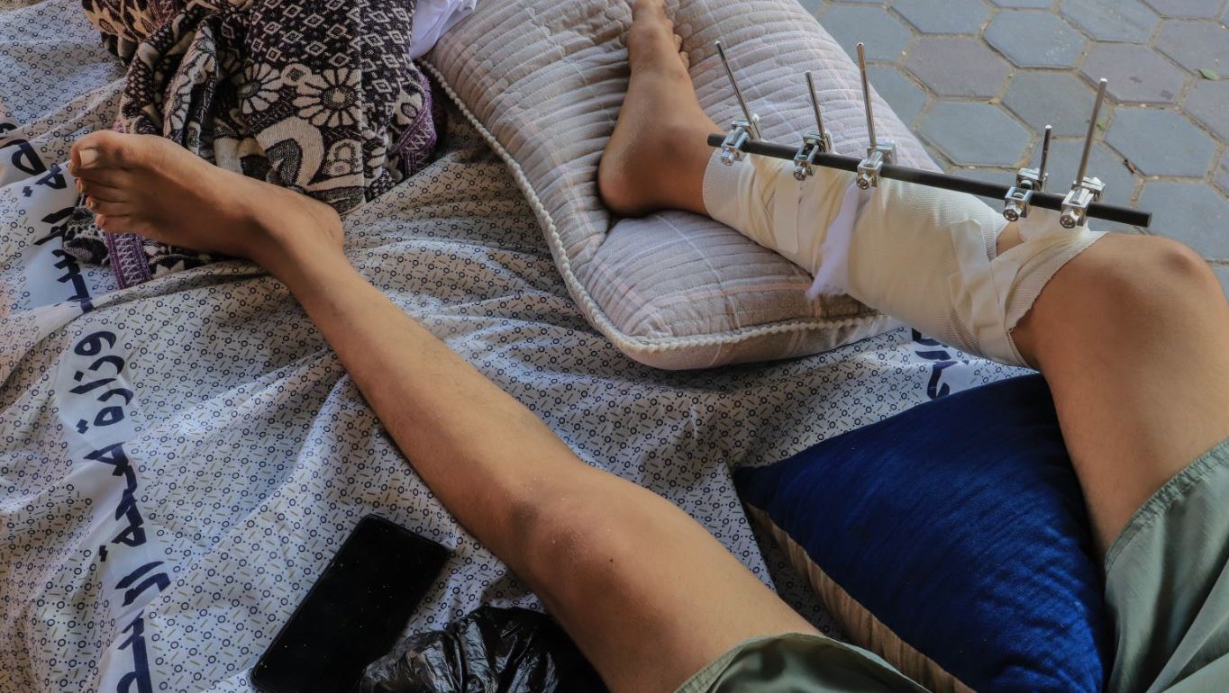 Vital emergency: Help Daoud (17) save his leg as quickly as 