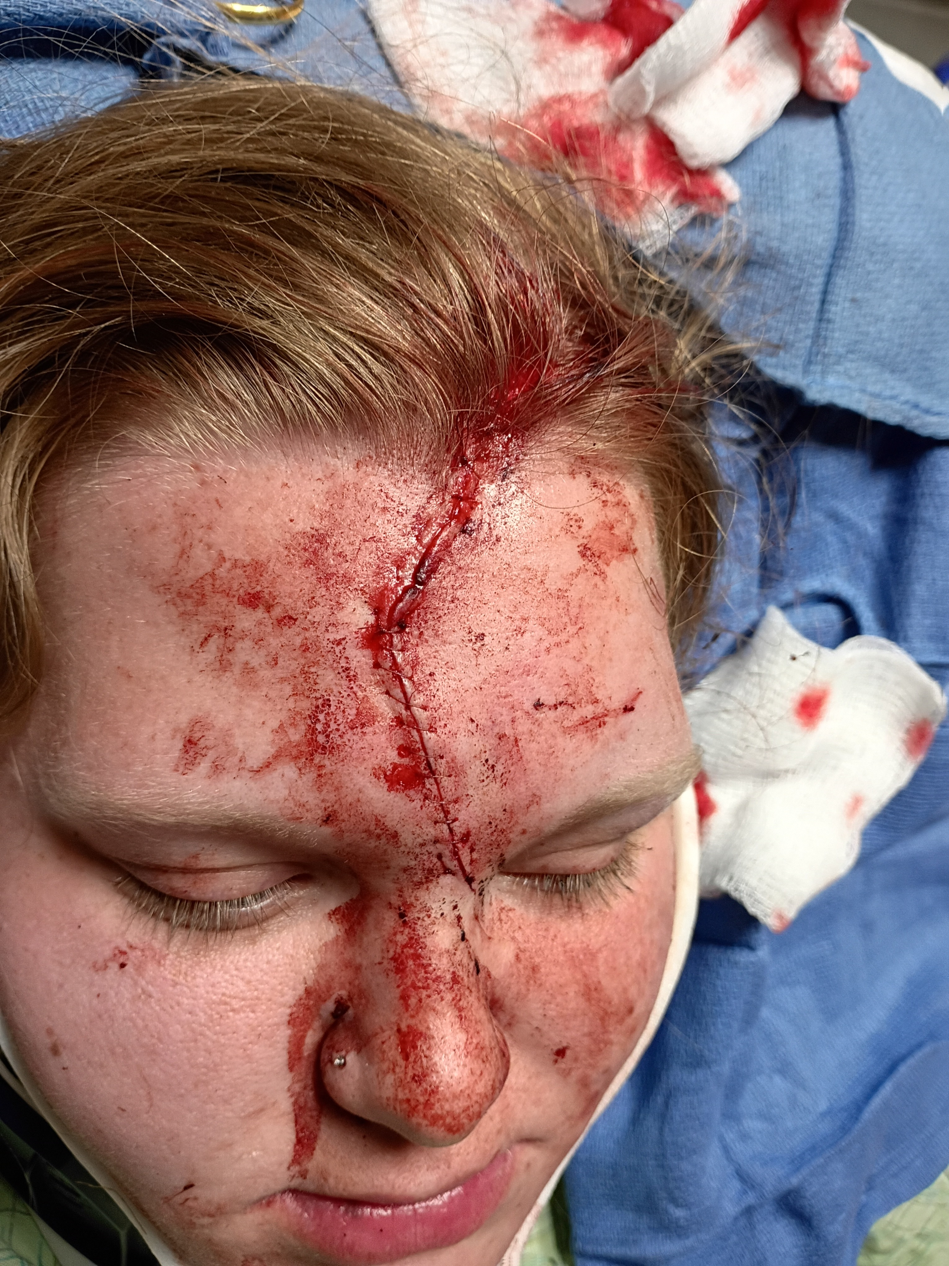 Support for Young Mom After Serious Accident campaign photo, 2 of 6