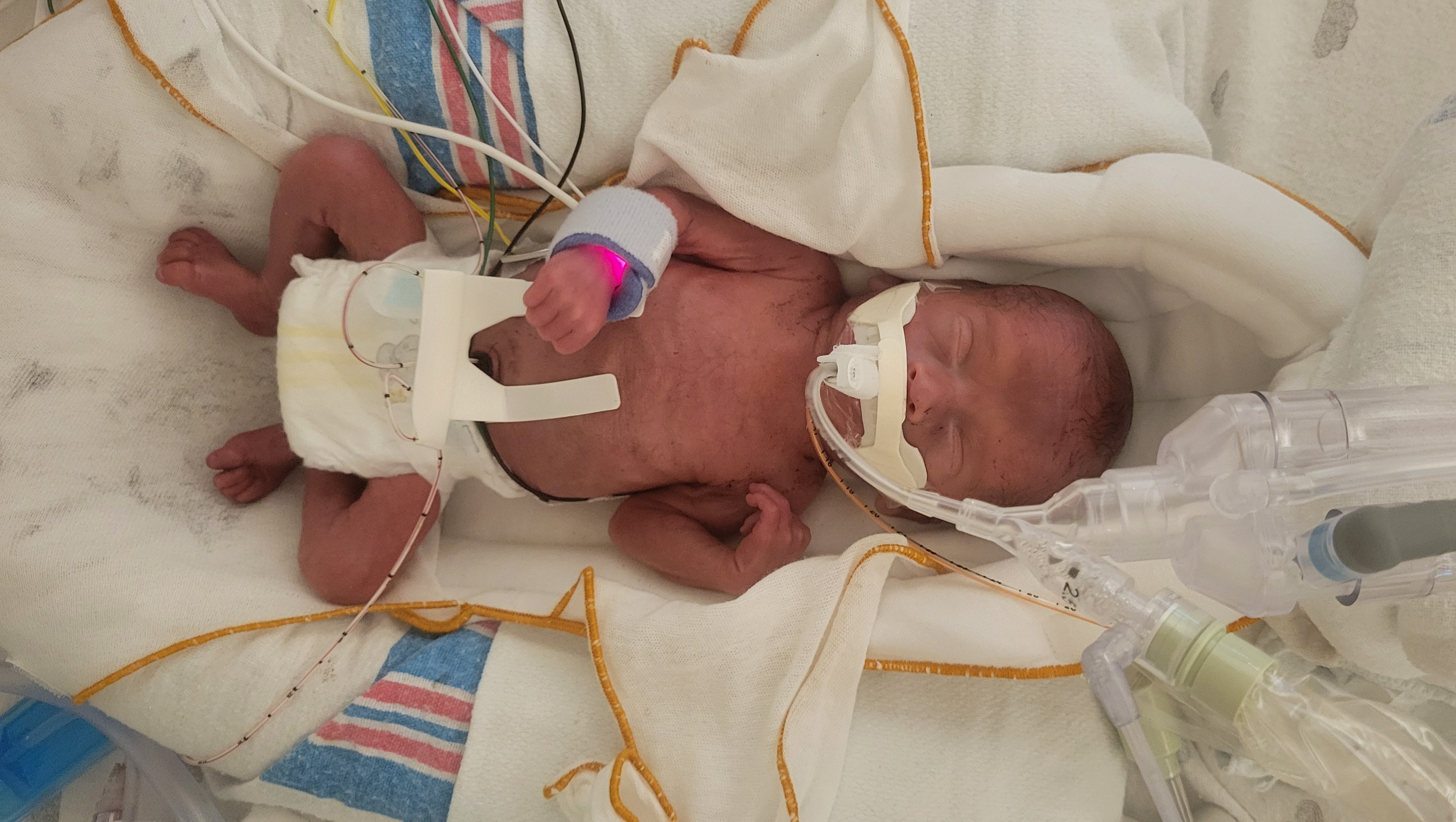 Support Baby Scott's NICU Journey