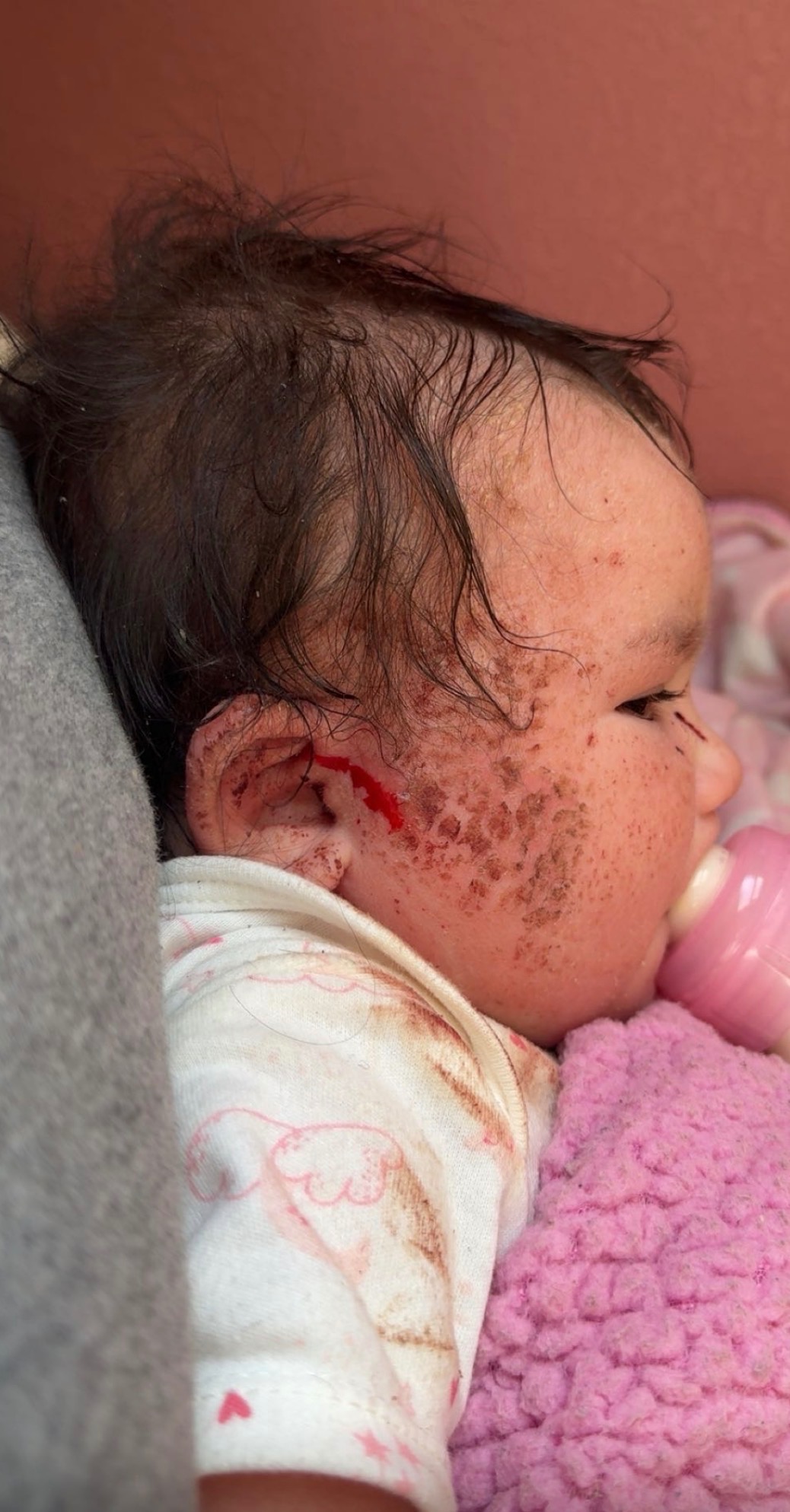 Help Amyla Get the Care She Needs at Mayo Clinic campaign photo, 7 of 8