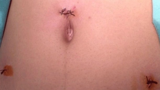 Help My Mother Recover from Surgery photo