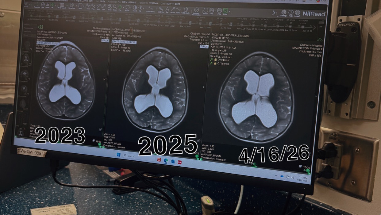 Support a Single Mom Through Son’s Brain Surgery photo