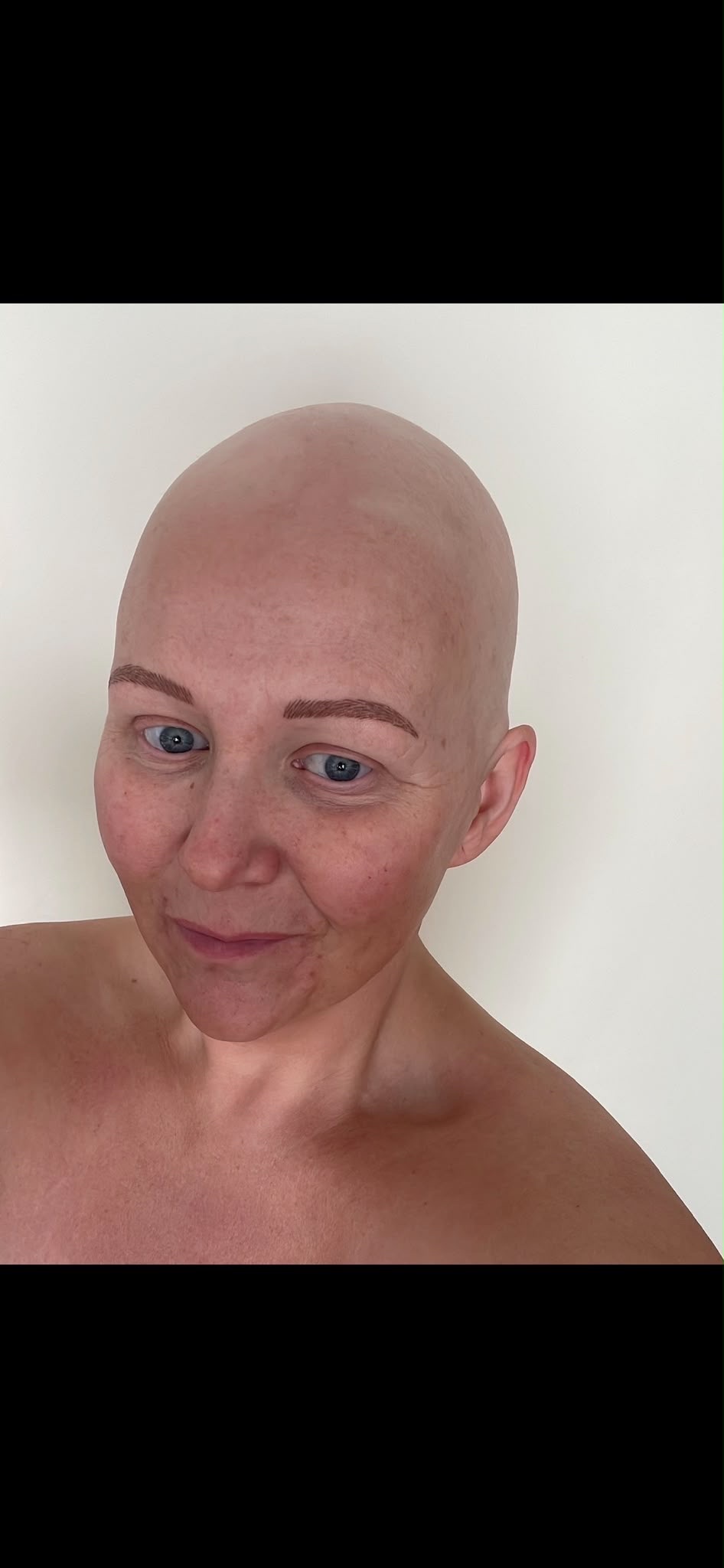 Fighting to Keep Living: Amy’s Story campaign photo, 6 of 8