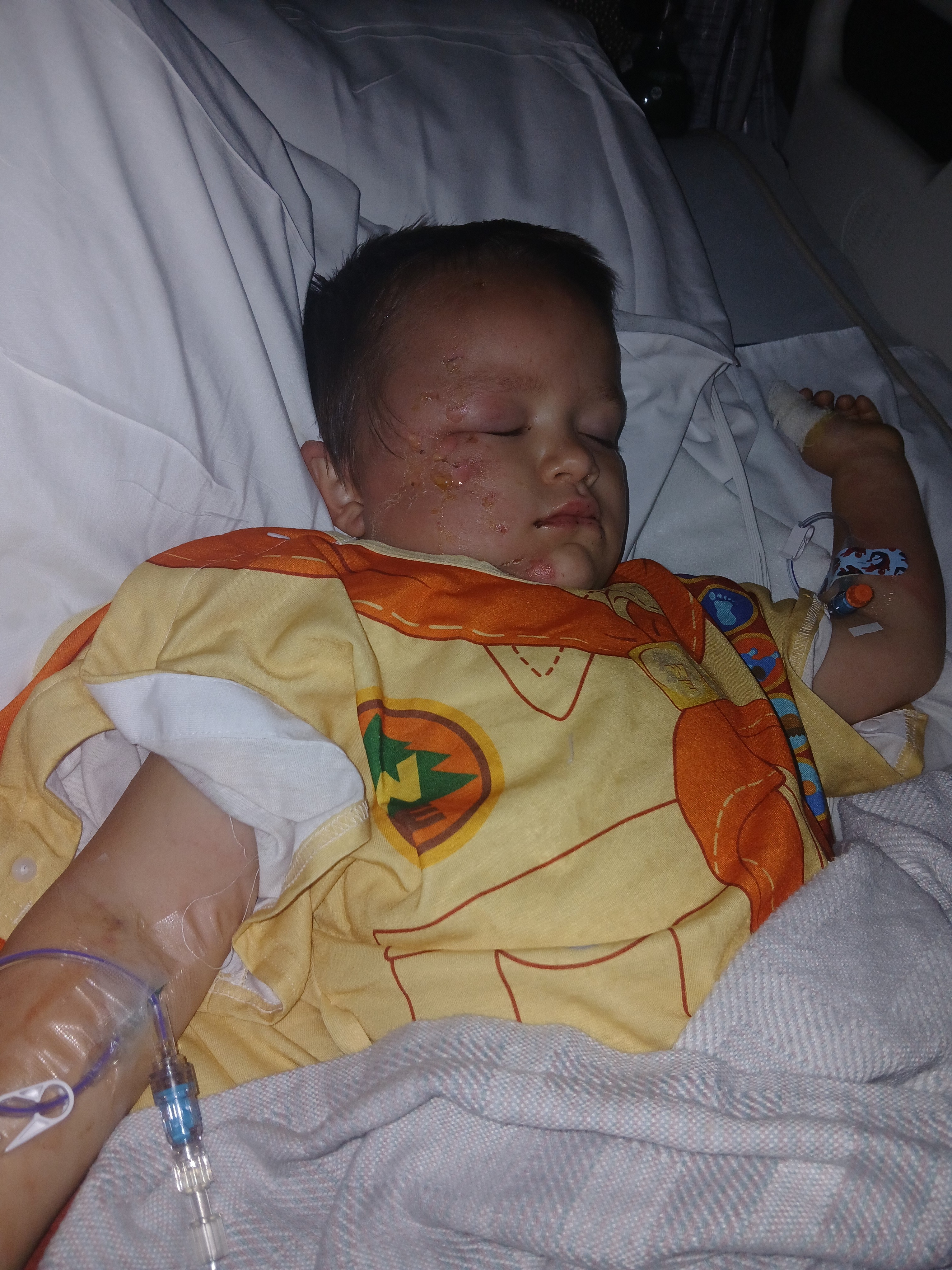 Lyle Roger's Burn Recovery campaign photo, 2 of 6
