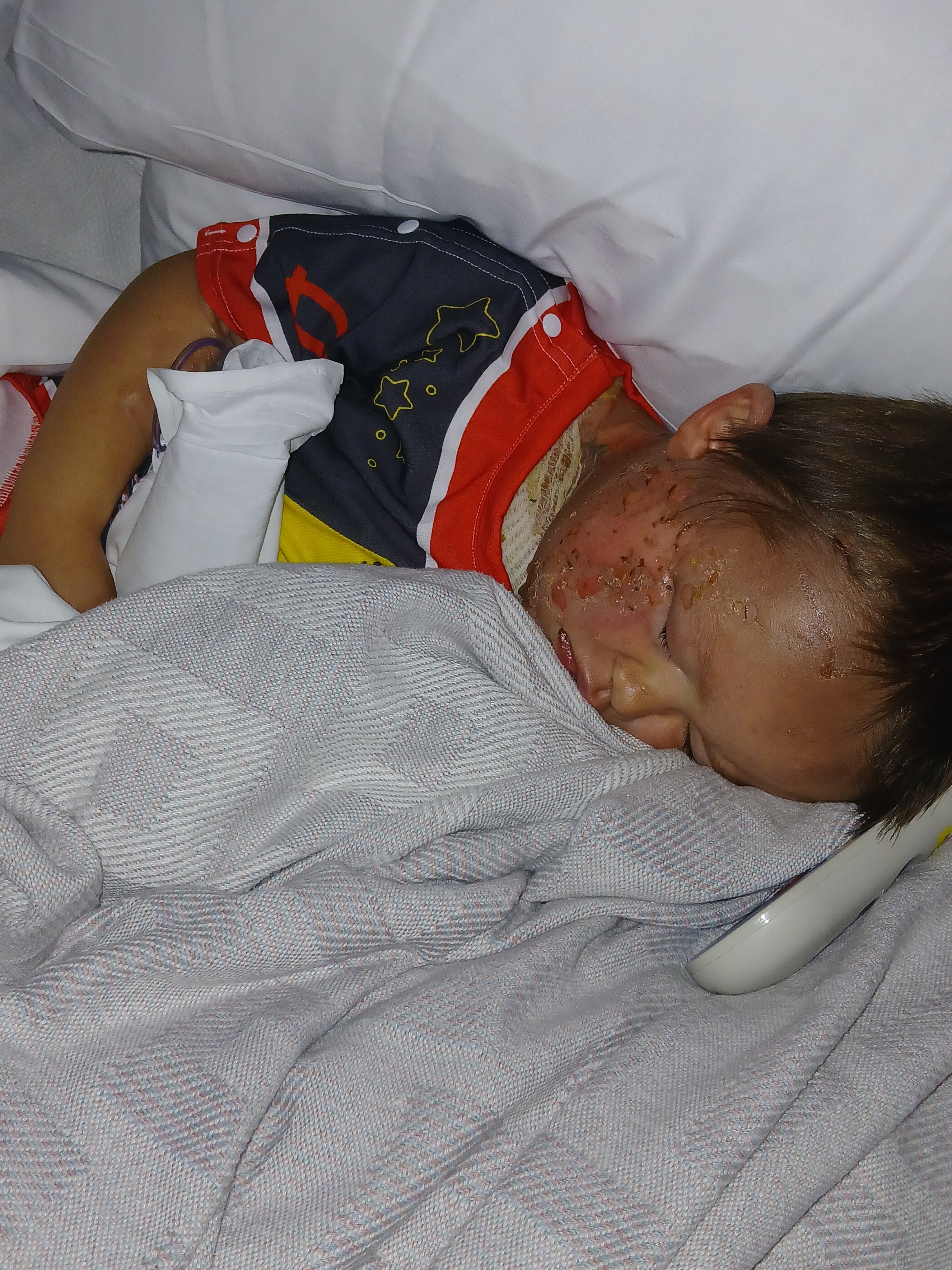 Lyle Roger's Burn Recovery campaign photo, 5 of 6