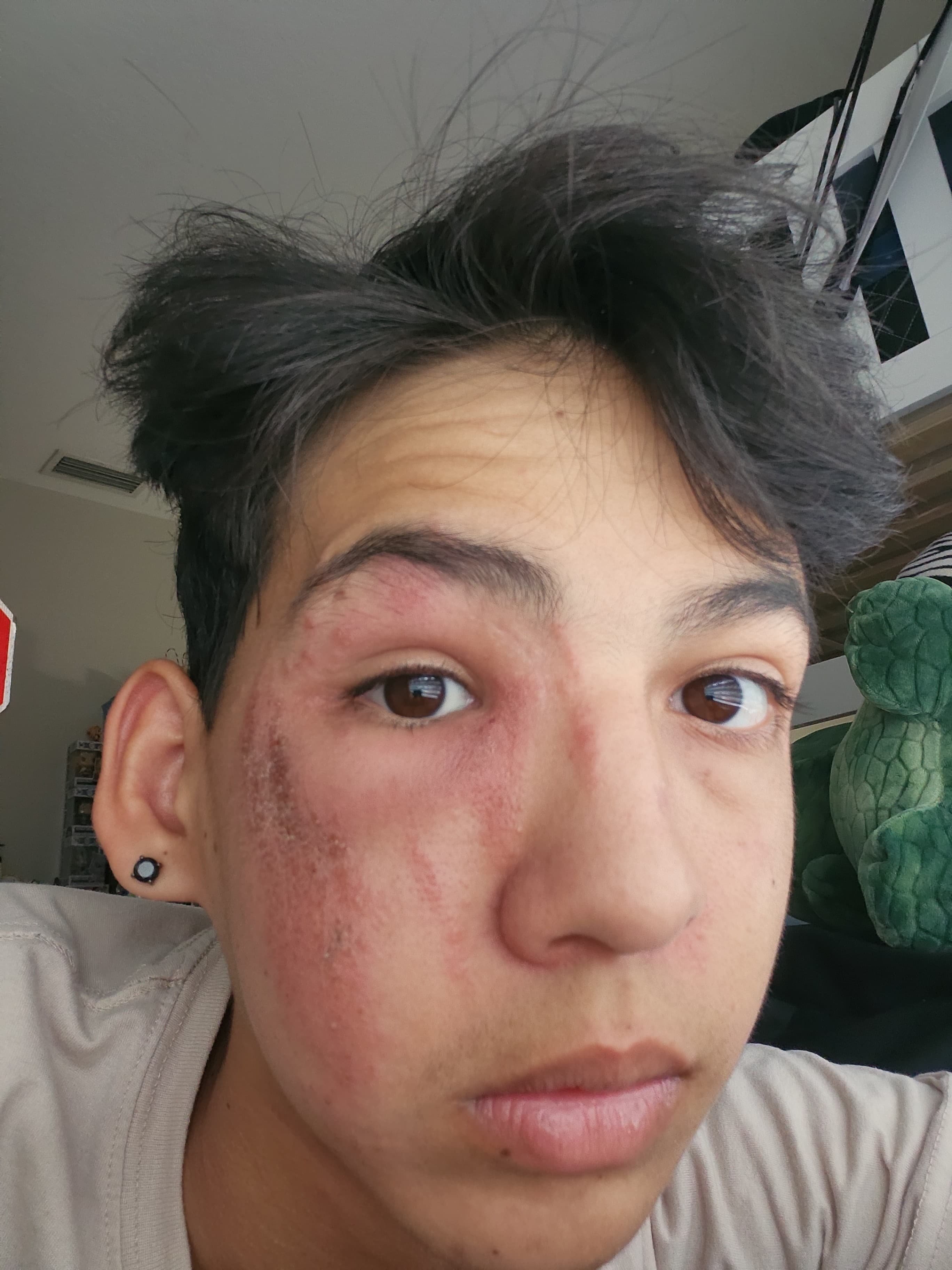 Help Us Recover After Son's Accident campaign photo, 2 of 8