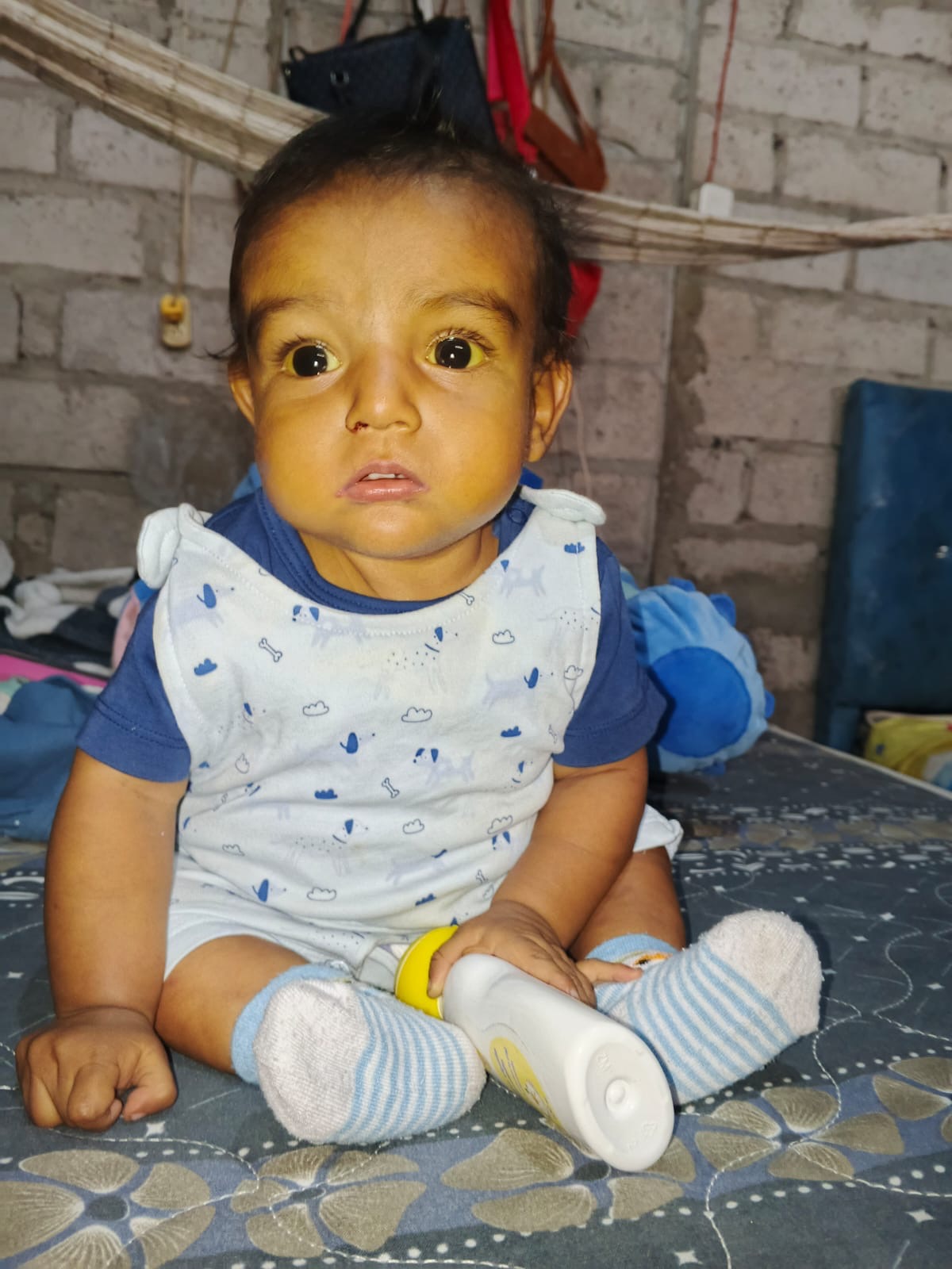    Save Baby Noah’s Life: Urgent Liver Transplant Needed campaign photo, 2 of 5