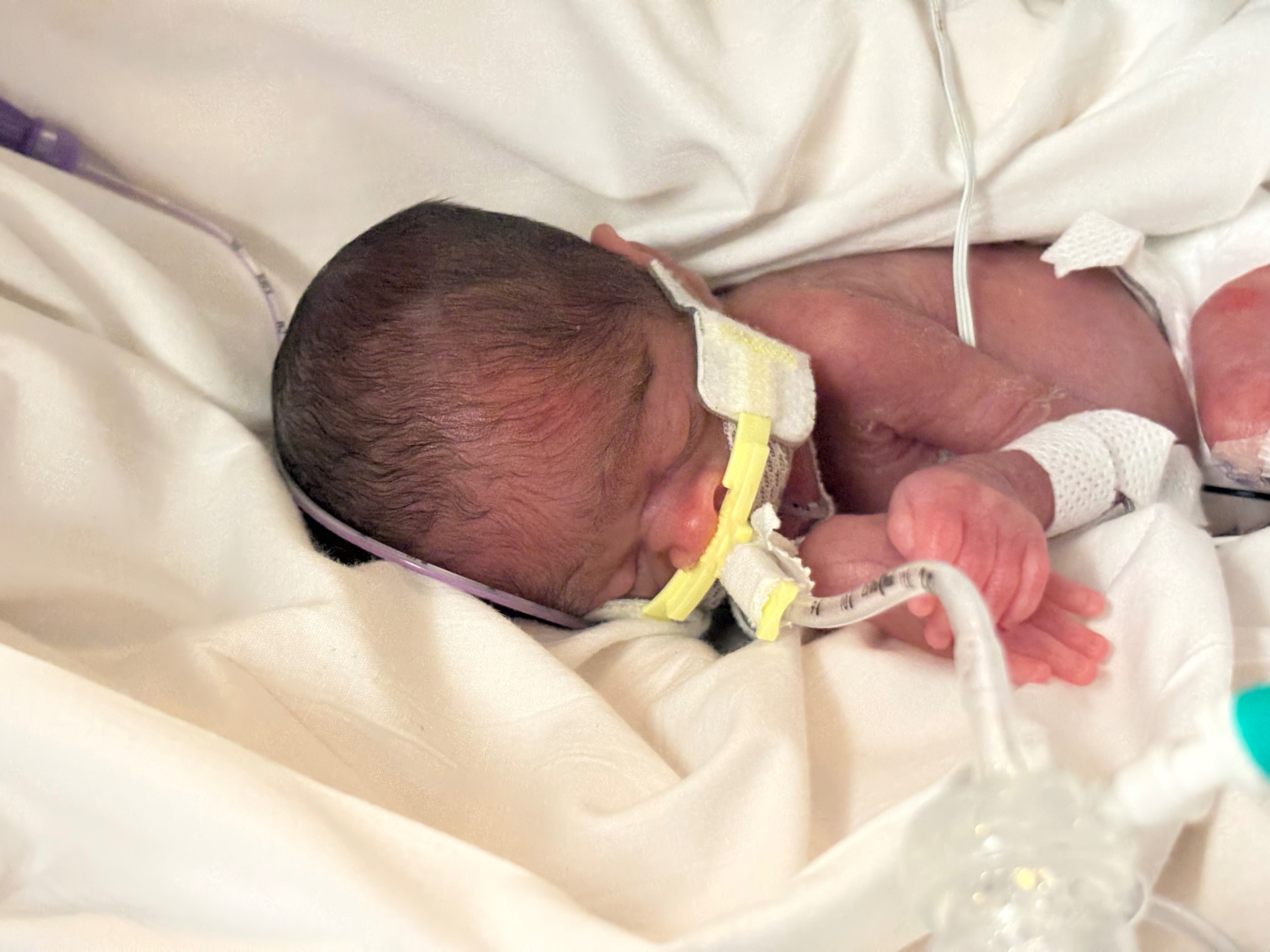 Fundraiser by Jordan Ransom : Support Baby Caliyanna's Early Fight