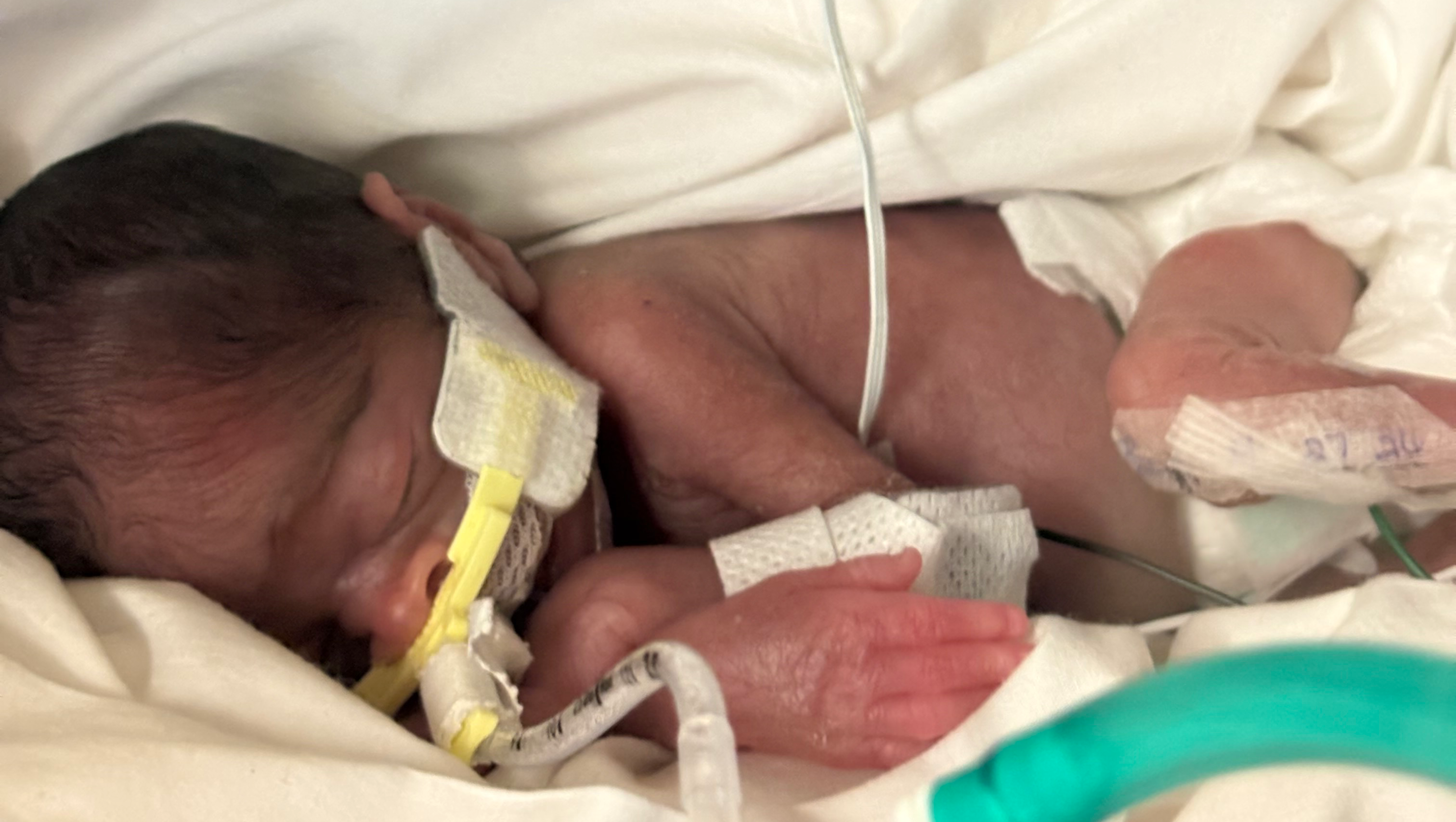 Jordan Ransom Fundraiser by Jordan Ransom : Support Baby Caliyanna's Early Fight