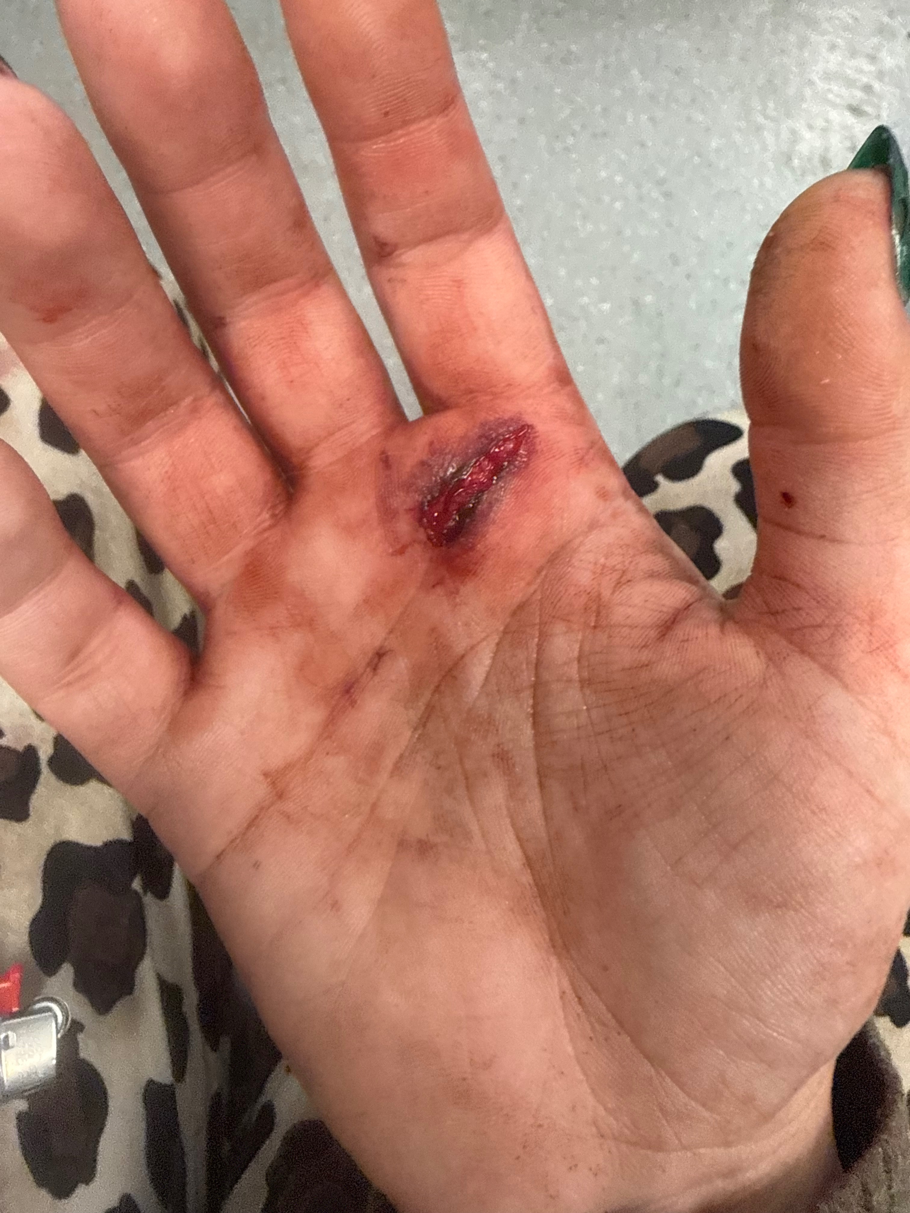 Help My Son Heal After Pit Bull Attack campaign photo, 2 of 7