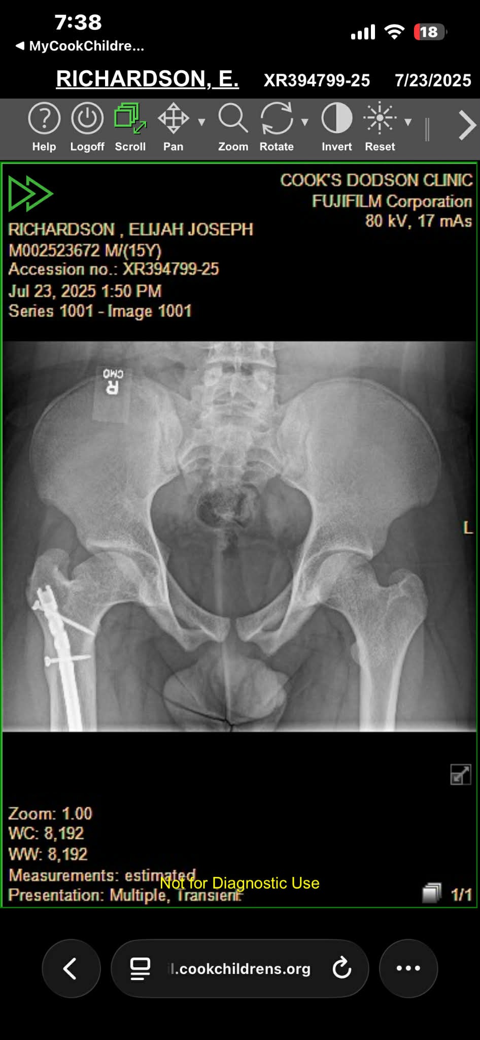 Support Angelica & Elijah’s Surgery Journey campaign photo, 4 of 8