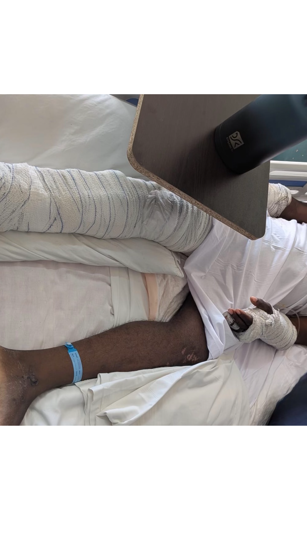 Fundraiser by Paulette C : Help My Brother Heal After a Devastating ...