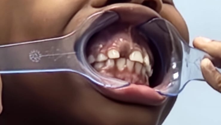 Support Sannique’s Journey to a Brighter Smile photo