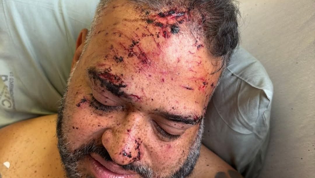 Help Joseph's Family Recover After Accident photo