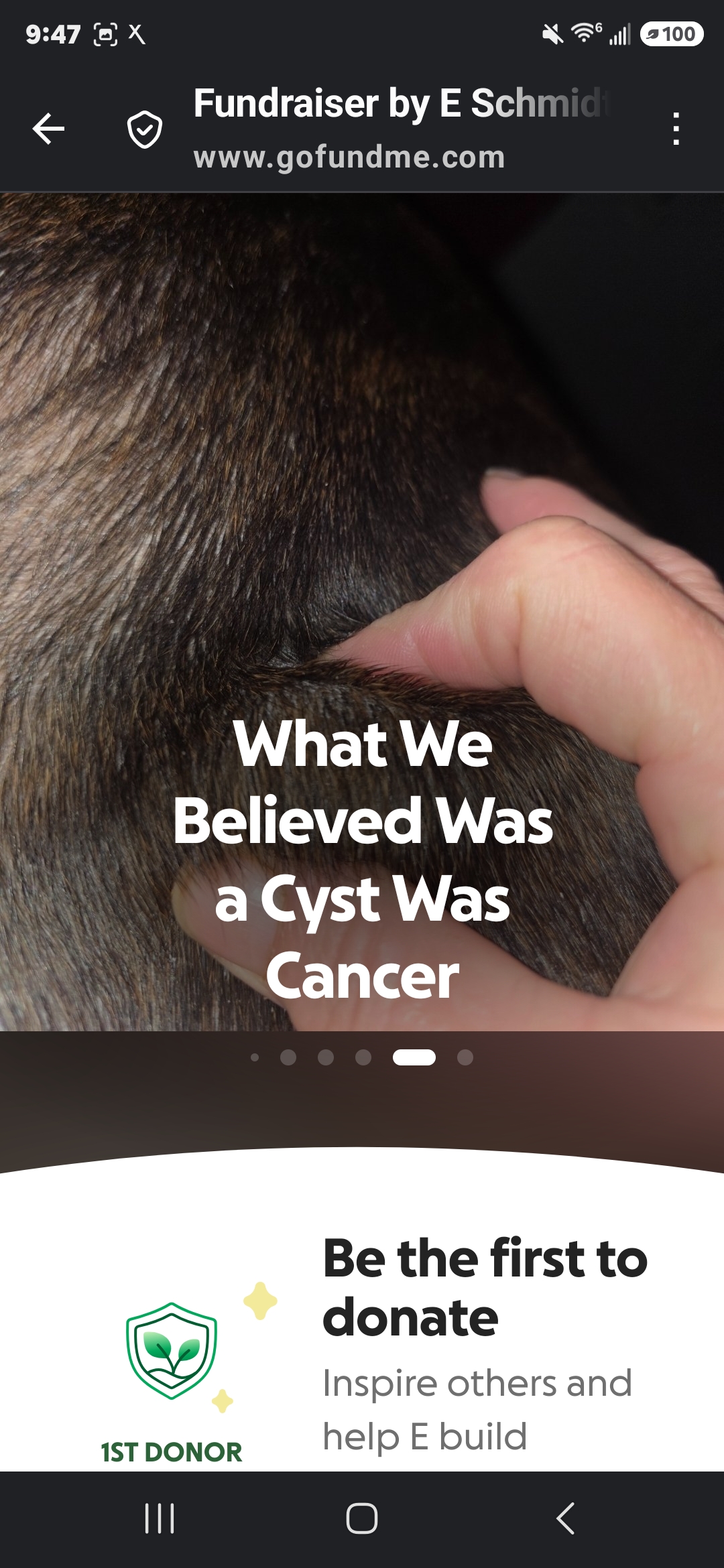 What We Believed Was a Cyst Was Cancer campaign photo, 7 of 12