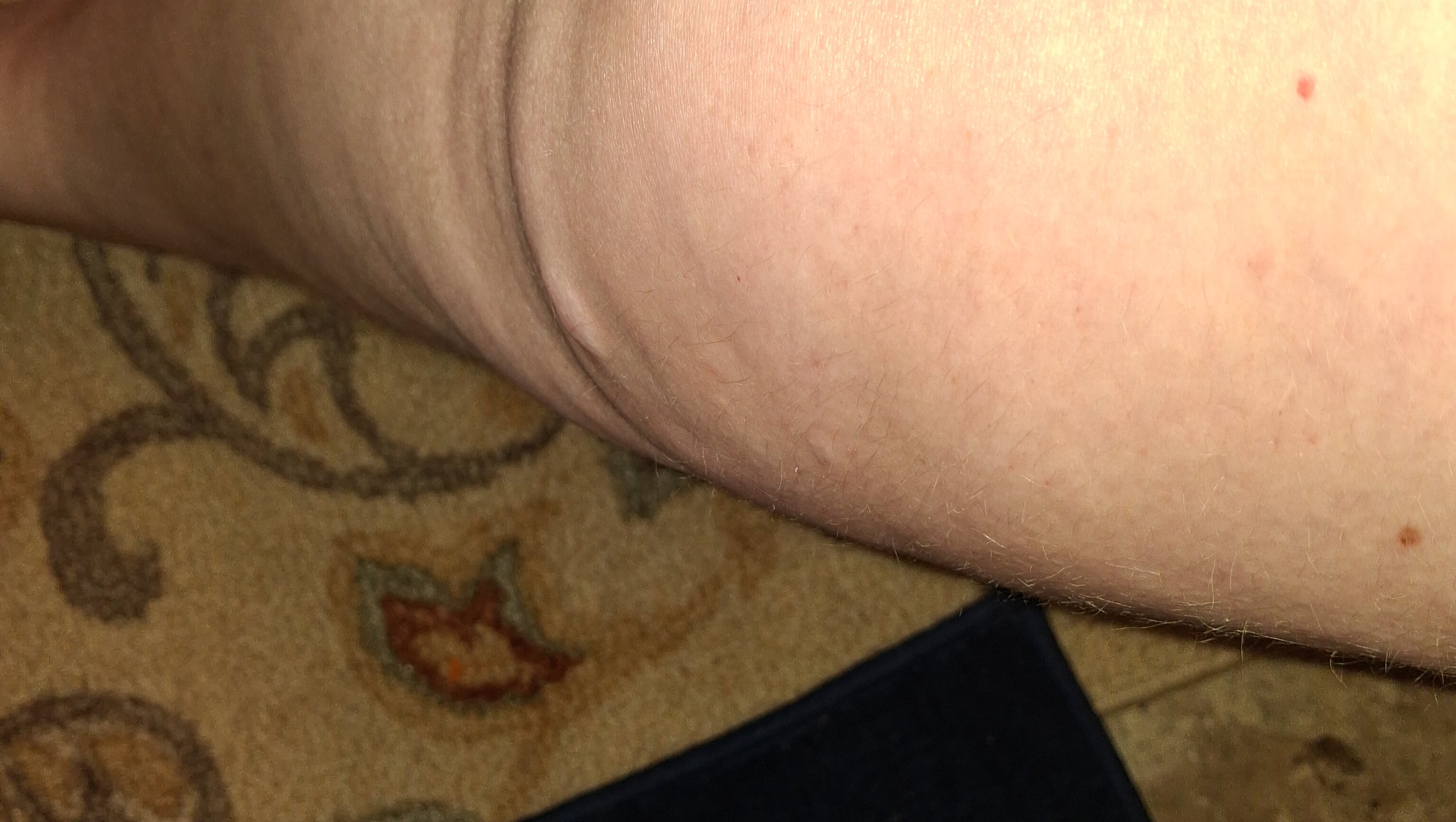 Support Michelle’s Recovery from Bone Cancer photo