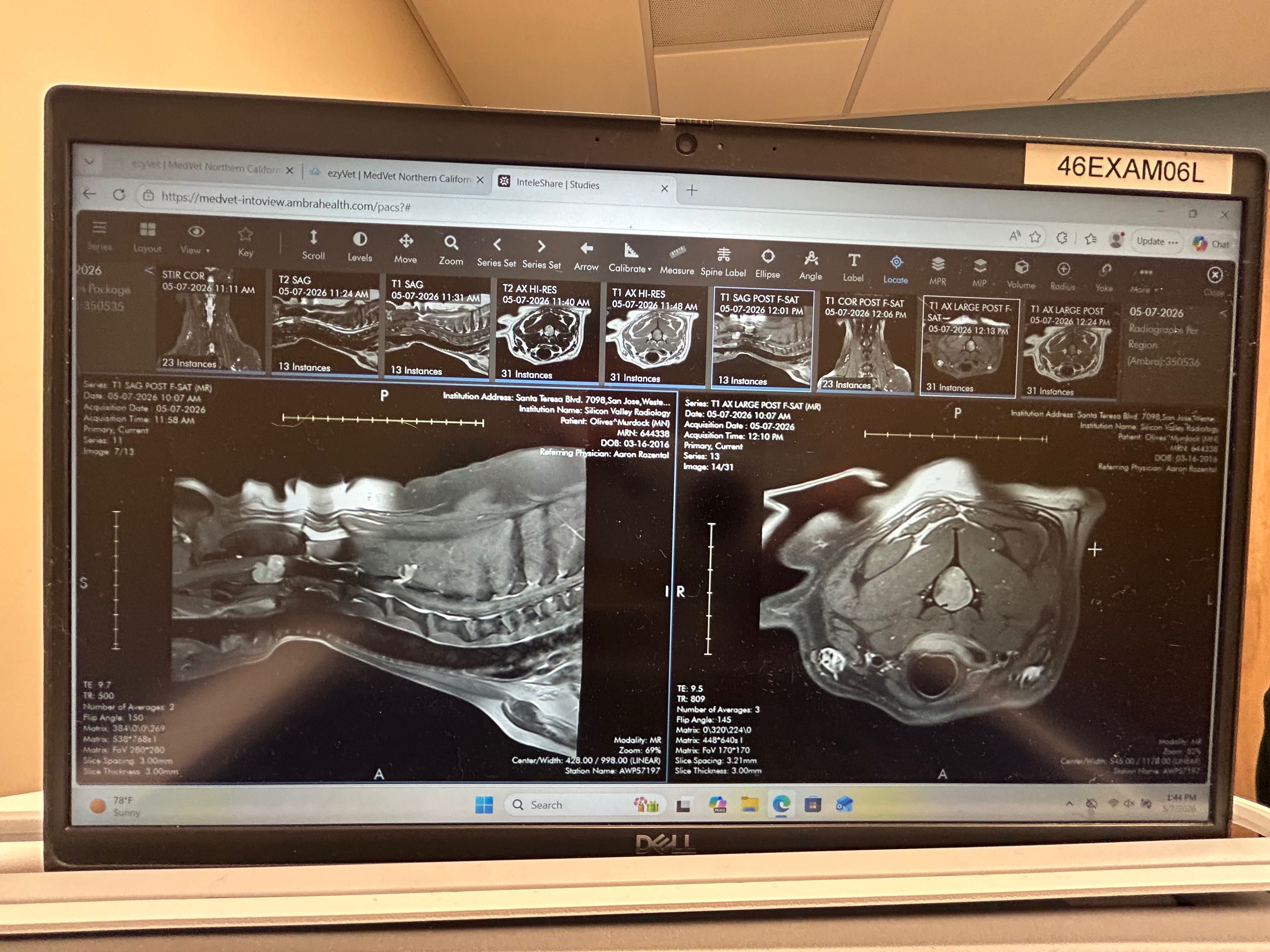 Help Murdock Fight His Spinal Tumor campaign photo, 2 of 8