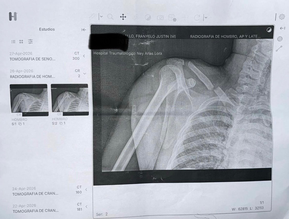 Urgent Support Needed for Franyelo’s Recovery campaign photo, 6 of 7