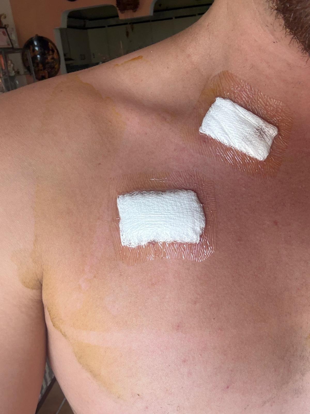 Foto de la recaudación de fondos Tratamiento para Sarcoma de Ewings, 6 de 8