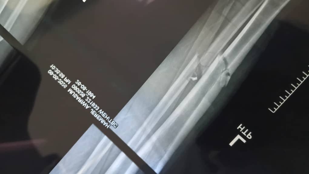 Raising support for Rue’s family after her husband’s injury campaign photo, 2 of 6