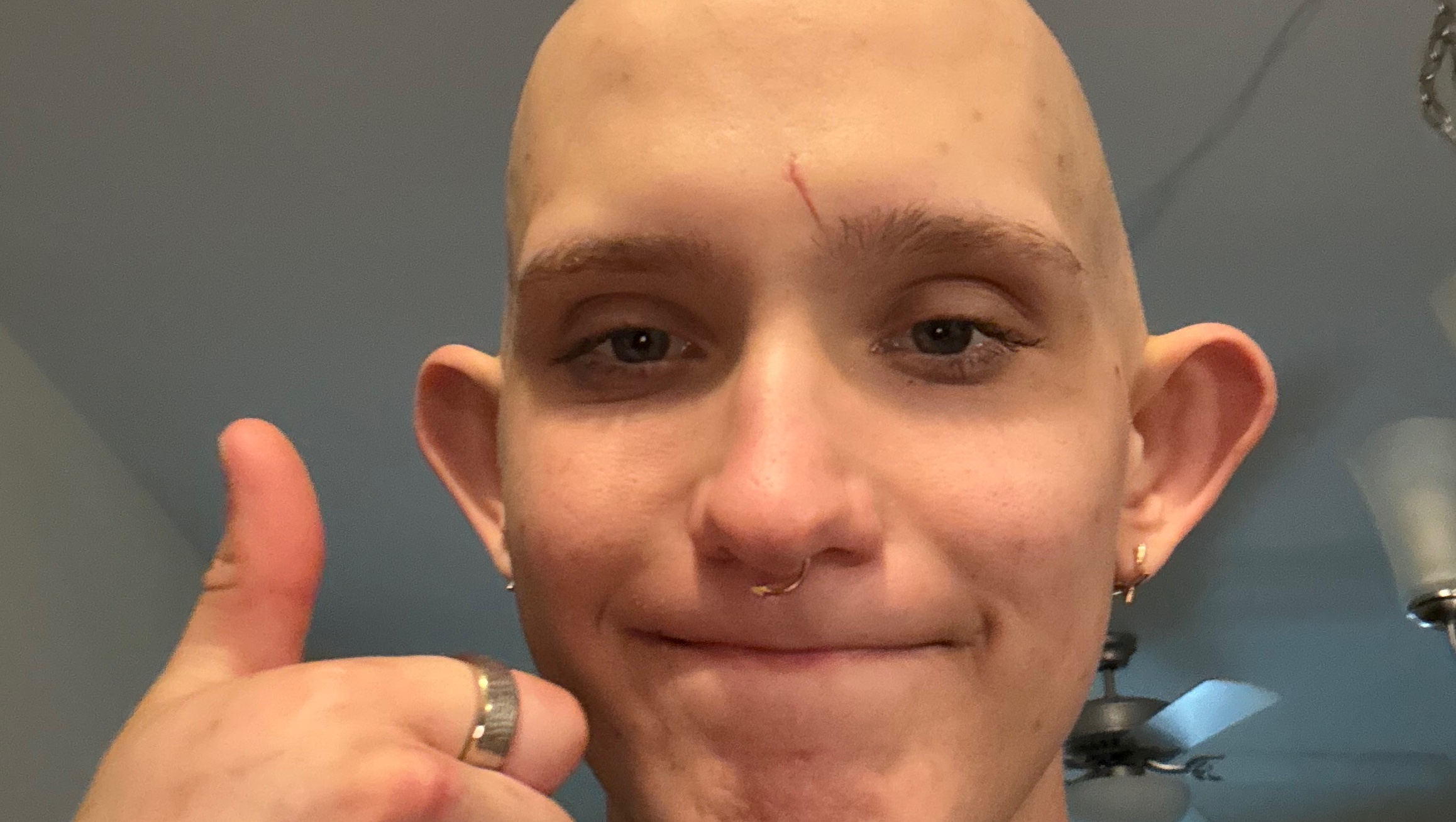 Support Dan’s Leukemia Recovery photo