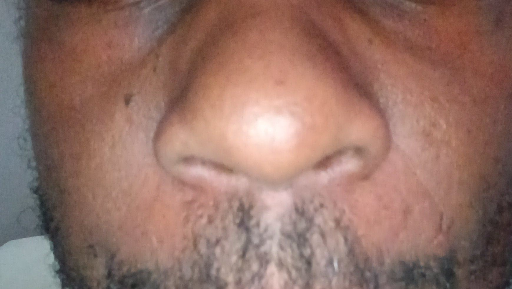 Support Dale's Everyday Living Needs photo