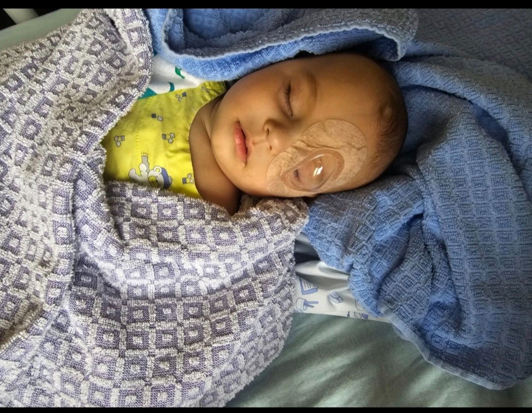 Kampagnen-Foto für Baby Augenoperationen, 2 von 7