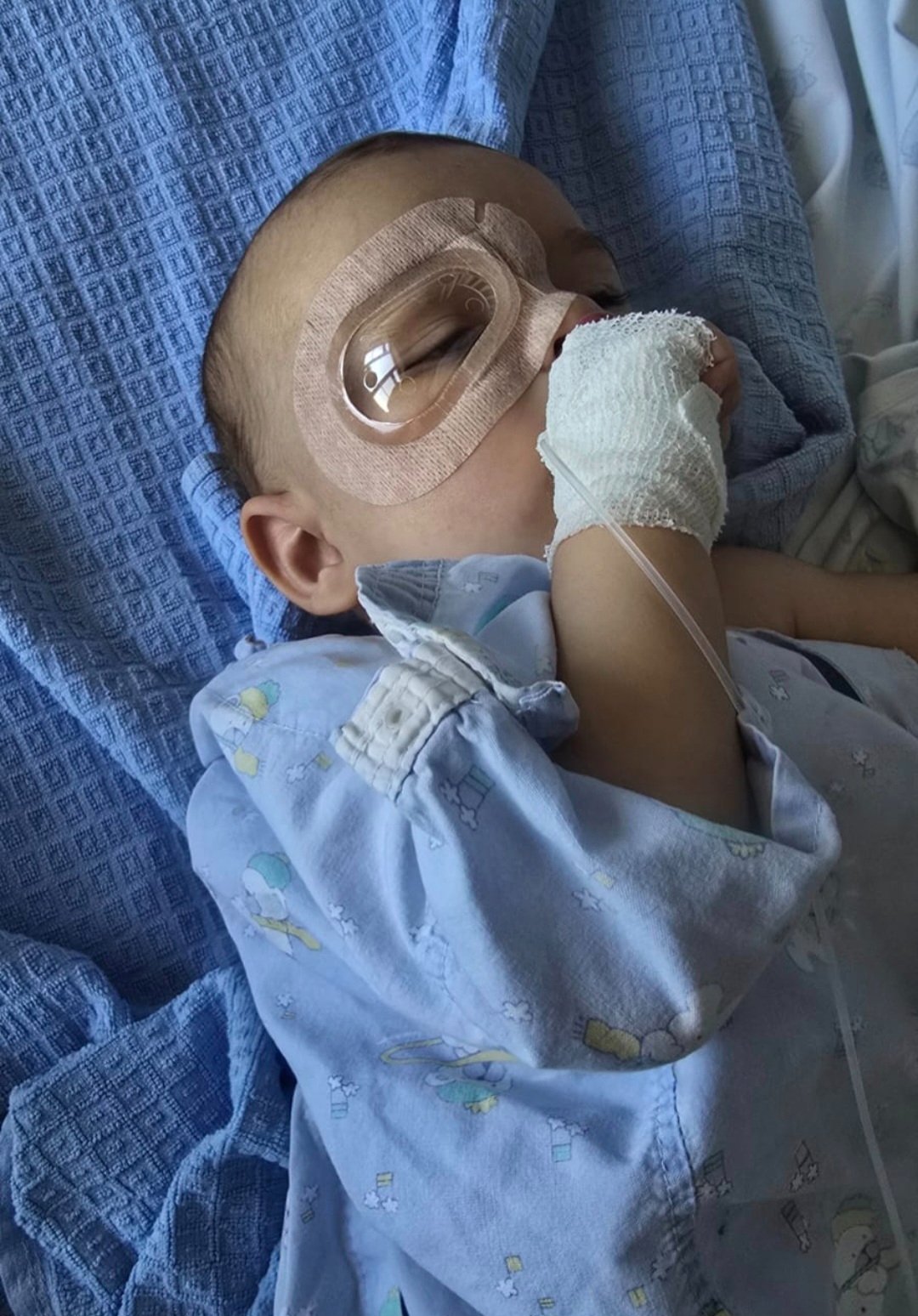 Kampagnen-Foto für Baby Augenoperationen, 4 von 7