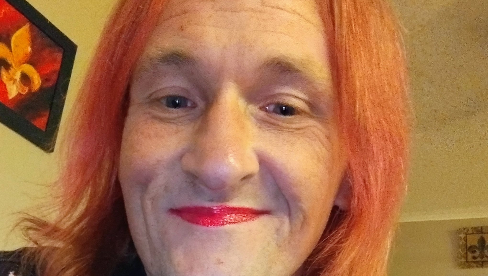 Support Andie's Surgery & Recovery photo