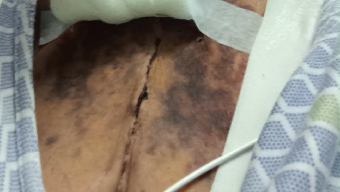Support Shannon Through Her Heart Surgery Journey photo