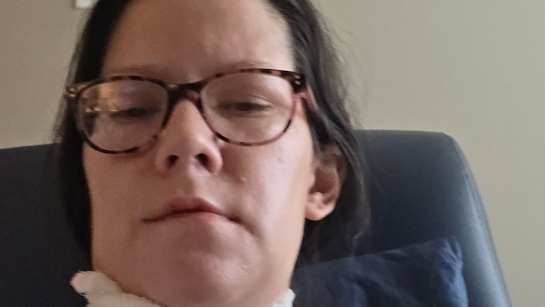 Help Me Get Dentures After Dental Surgery photo