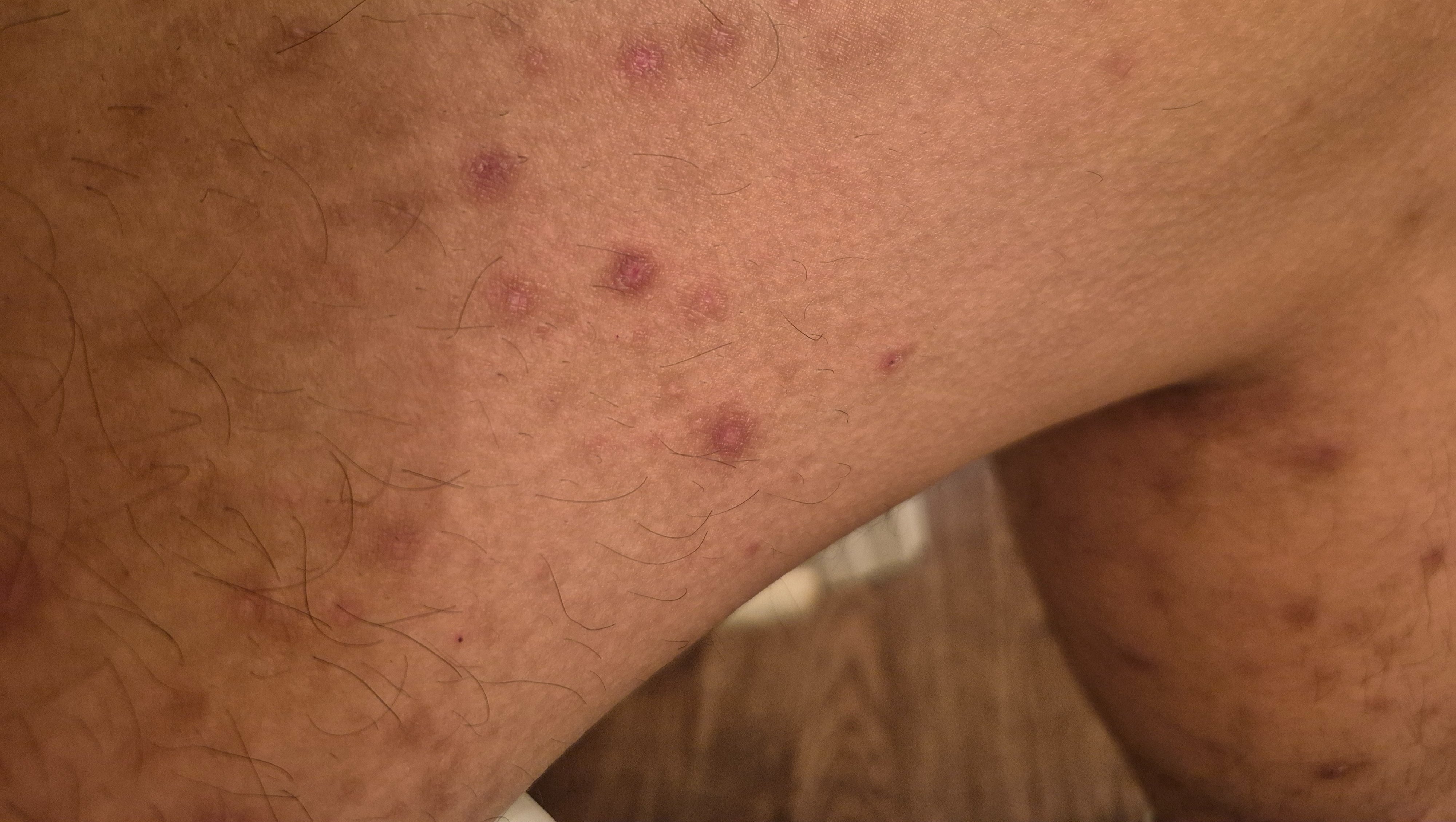 Support Needed for Essential Medical Care photo