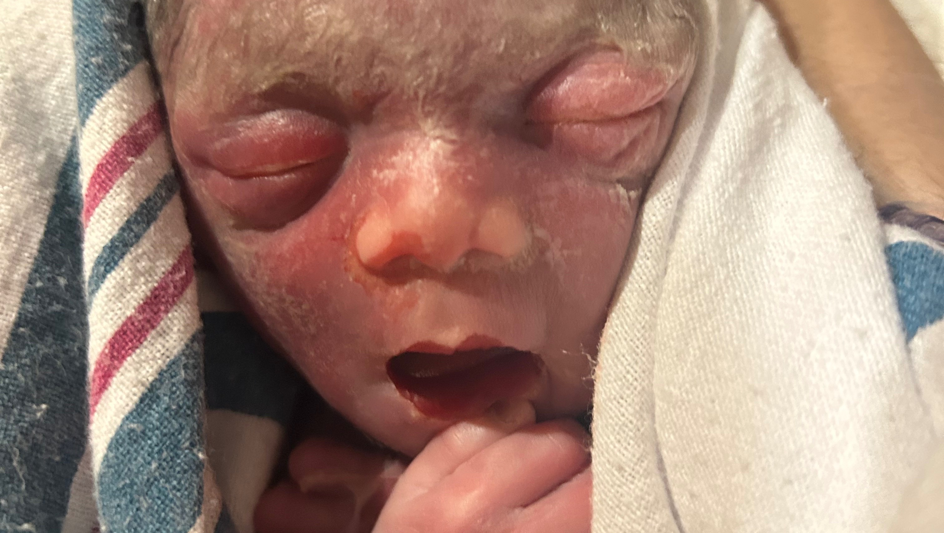 Baby khaild lost at 7 months  photo