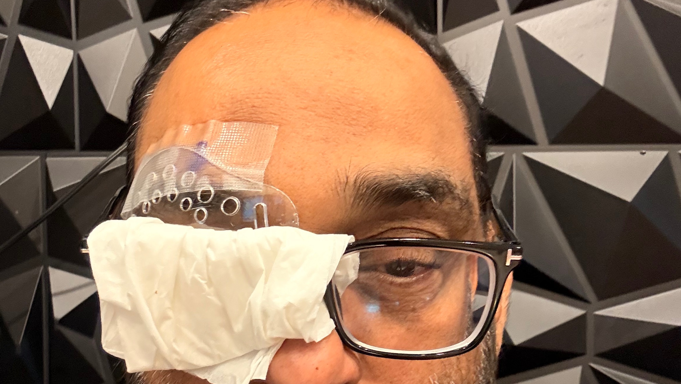 Last three months I have three surgeries no working photo