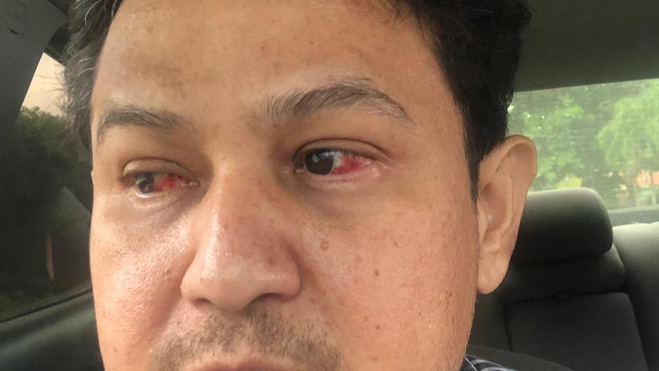 Help Freddy Save His Sight photo