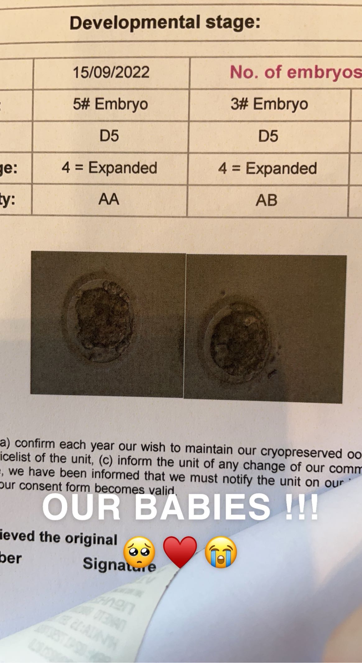 IVF Wasn’t Enough: My Battle with Endo, Adeno, and Lupus campaign photo, 5 of 8